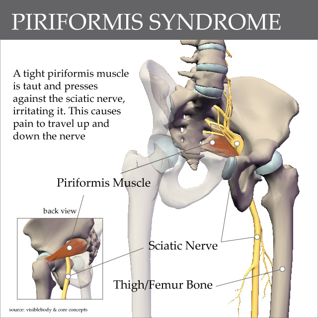 Skeleton of Pelvis showing Piriformis Muscle and Sciatic Nerve