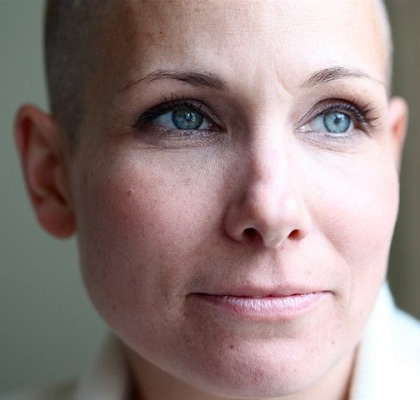 Woman with Cancer